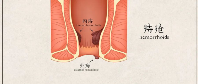 北京丰益肛肠医院怎么样 去肛肠科就诊前患者需做哪些准备？